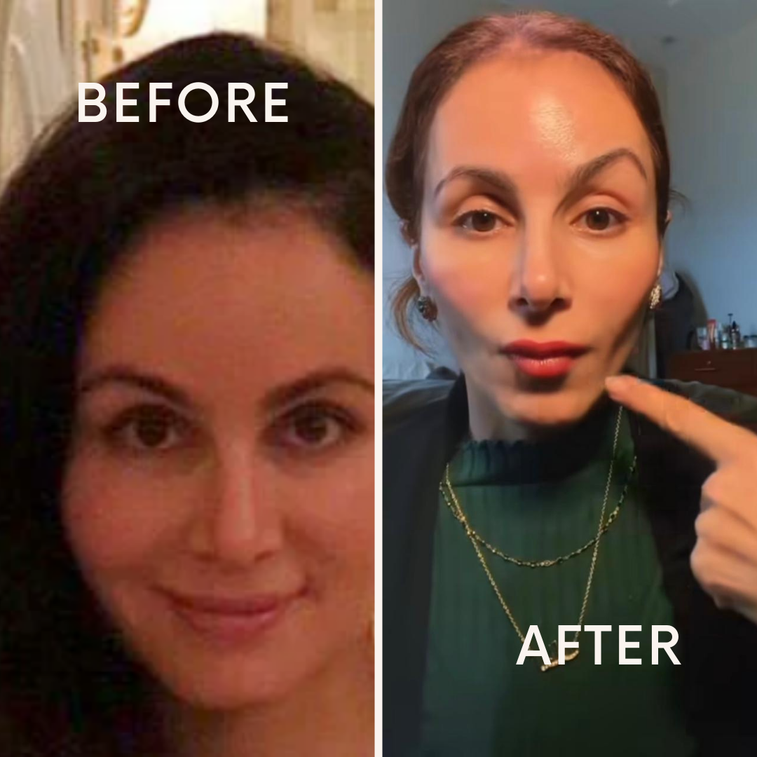 before vs after revive